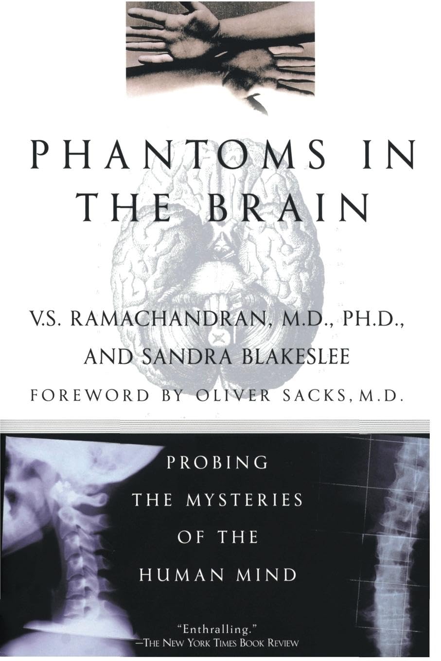 Phantoms in the Brain